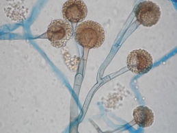 Грибок мукора под микроскопом | Статьи на сайте Познавая Мир